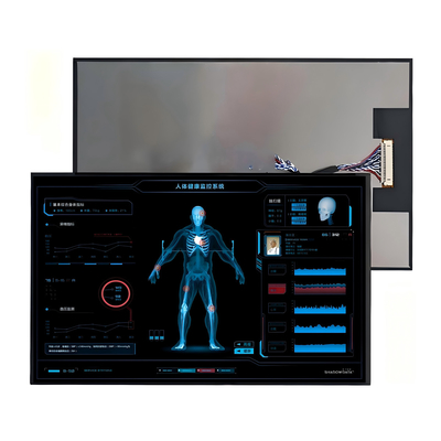 10Écran LCD TFT de 0,1 pouce - Écran tactile haute résolution pour l'industrie et l'automobile